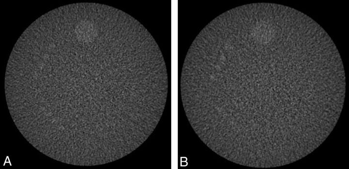 Fig 3.