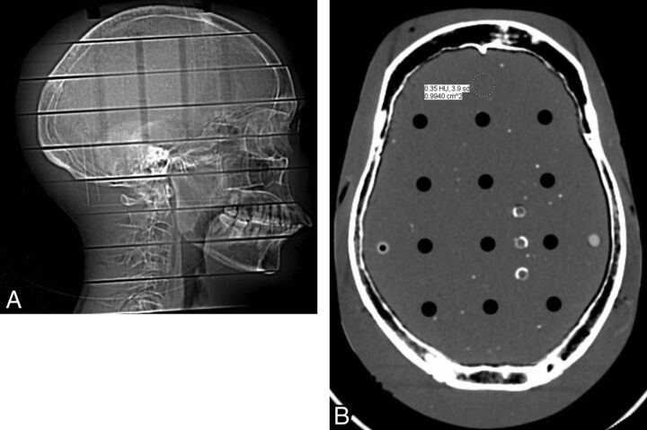 Fig 1.