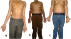 Fig. 1