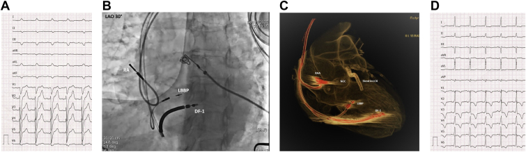 Figure 2