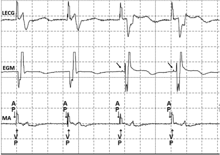 Figure 3