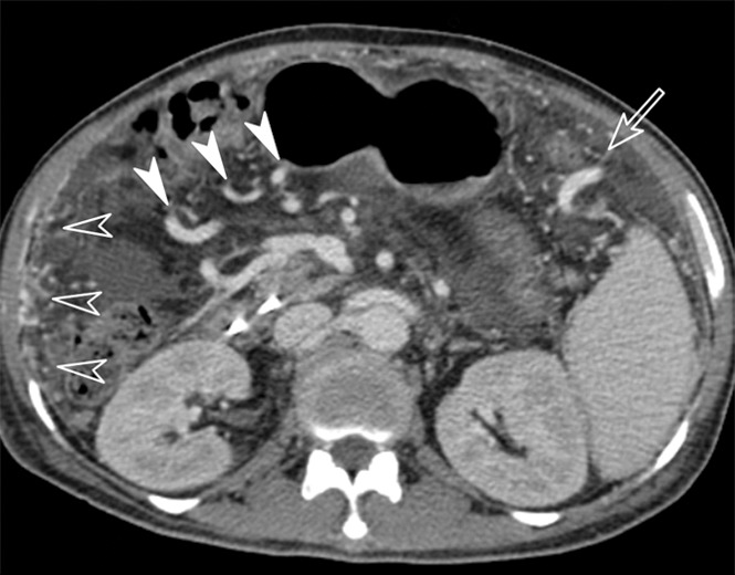 Figure 5c: