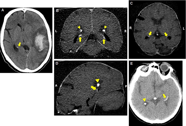 Fig 1