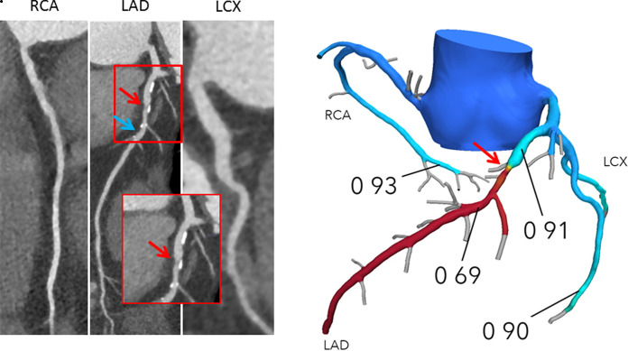 Figure 1b: