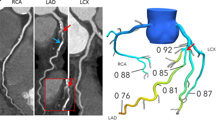 Figure 1a: