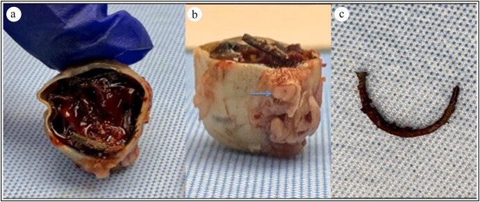 Figure 3.