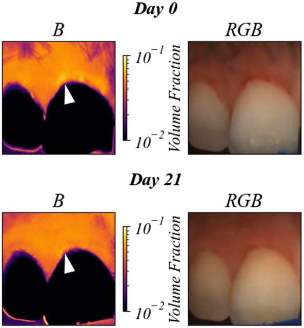 Fig. 10