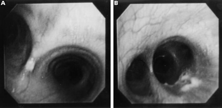 Figure 2  