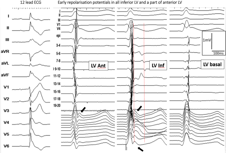 Figure 5