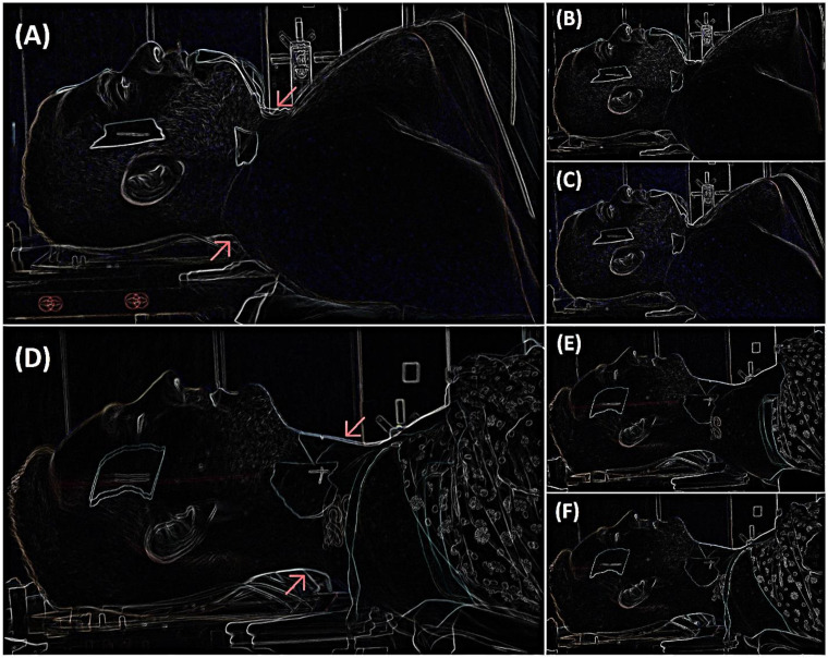 Figure 4.
