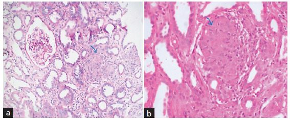 Figure 2: