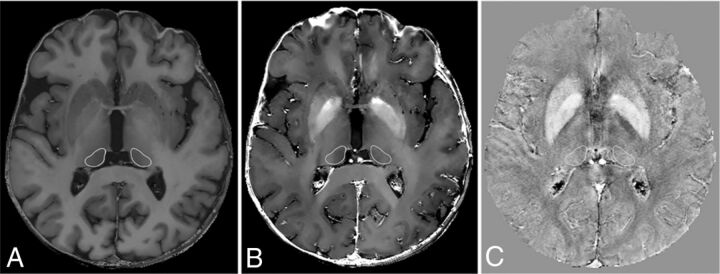 Fig 1.