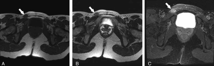 Figure 3)