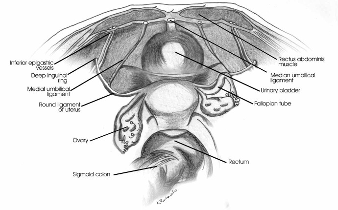 Figure 1)