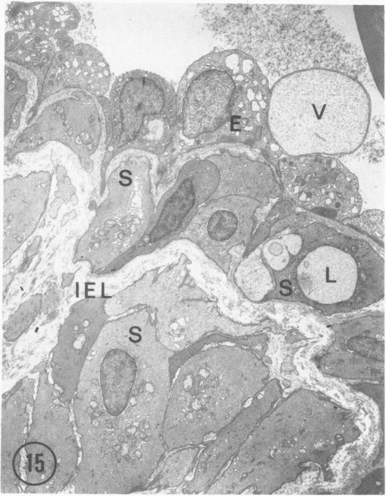 Figure 15