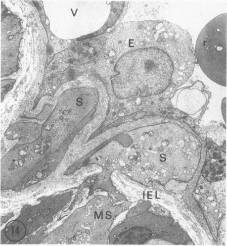 Figure 14