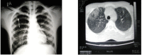 Fig.2