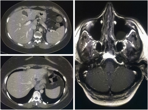 Fig. 5