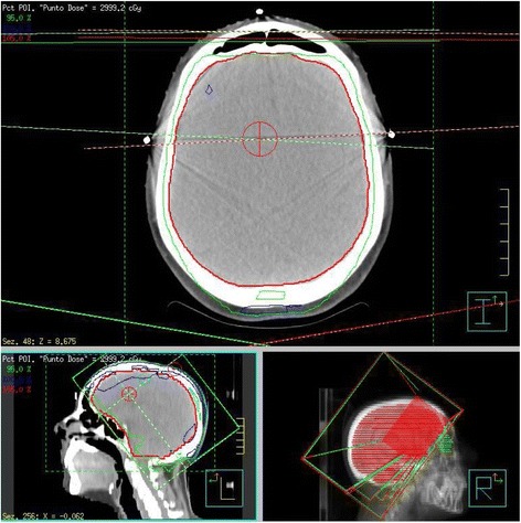 Fig. 3