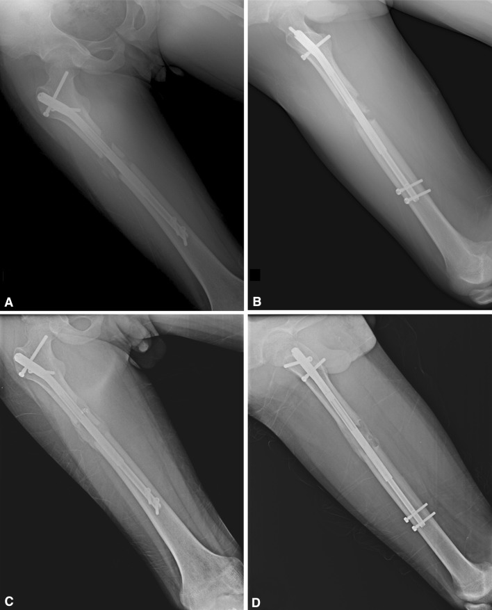 Fig. 2A–D