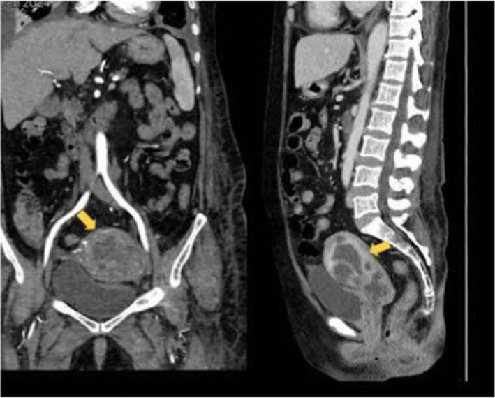 FIGURE 1