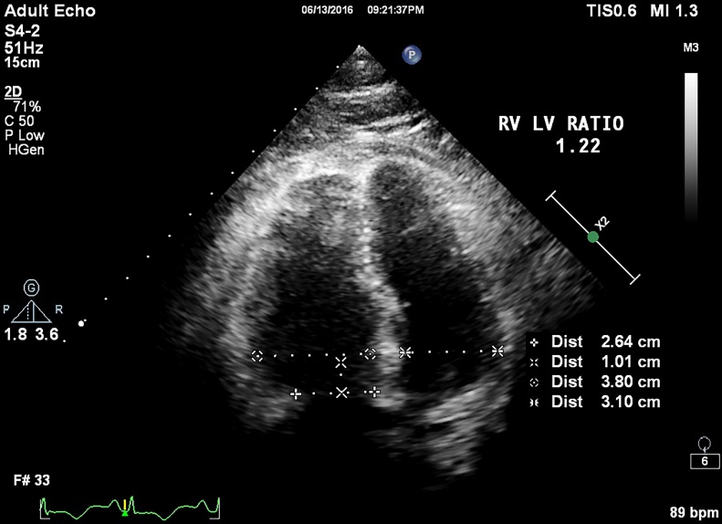 Fig. 2