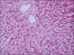 Figure-14