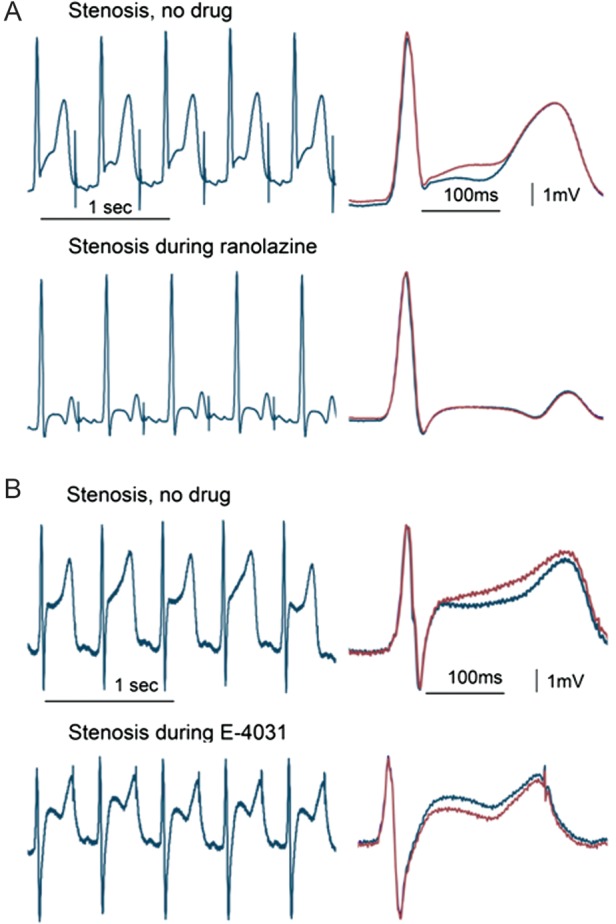 Figure 4