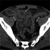 Fig. 12