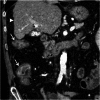 Fig. 16