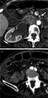 Fig. 21