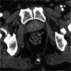 Fig. 17