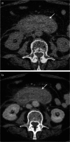 Fig. 19