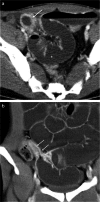 Fig. 20