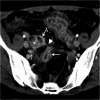 Fig. 13