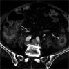 Fig. 14