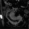 Fig. 10