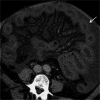 Fig. 11