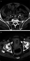 Fig. 22