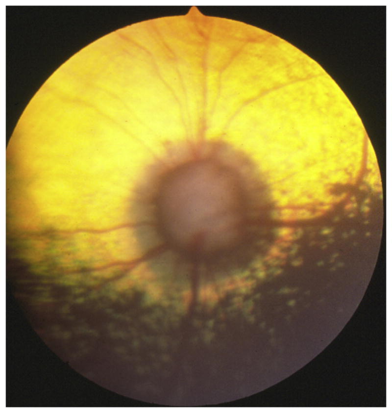 Fig. 9
