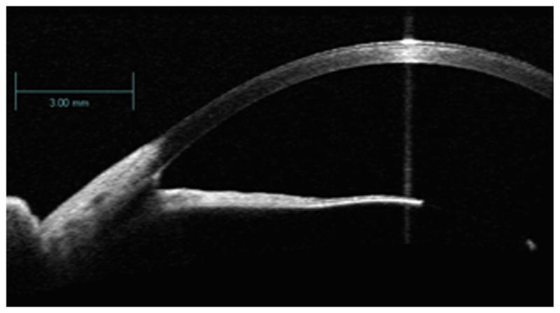 Fig. 16