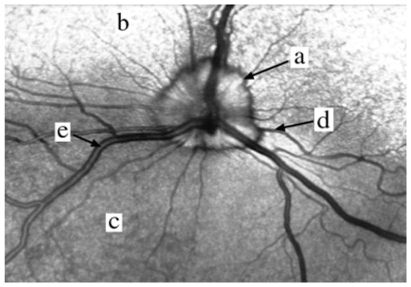 Fig. 17