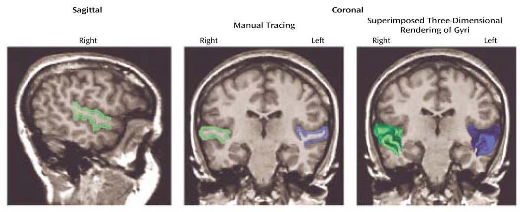 FIGURE 1