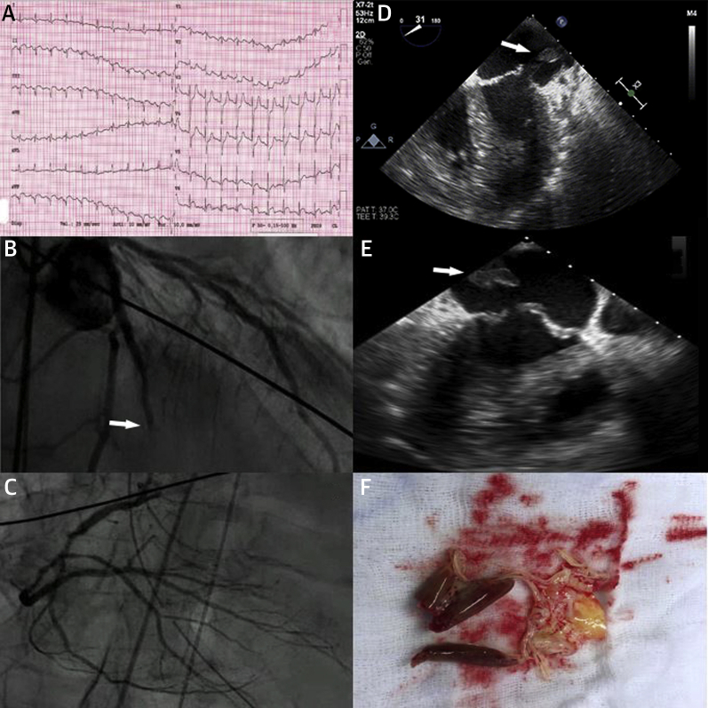 Figure 1