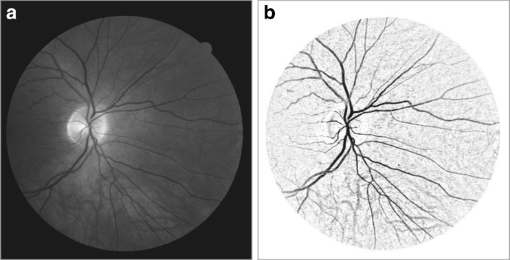 Fig. 4