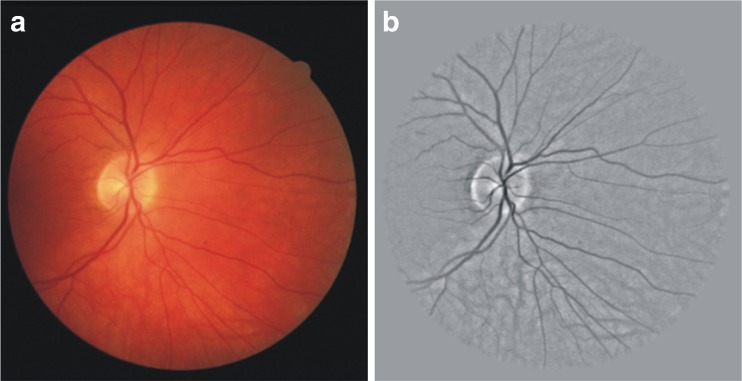 Fig. 2