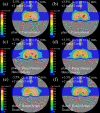 Fig 6