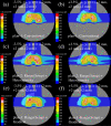 Fig 9