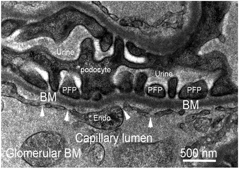 Basement Membranes in the Cornea and Other Organs that Commonly Develop ...