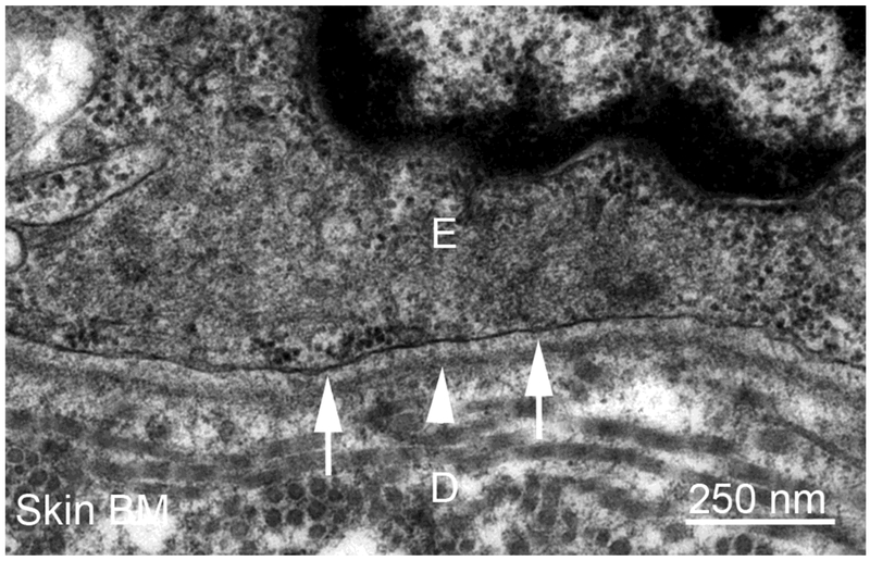 Basement Membranes in the Cornea and Other Organs that Commonly Develop ...